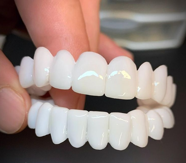 Adjustable Invisible Whitening Braces – 100% Holeless Design for a Natural, Perfect Smile