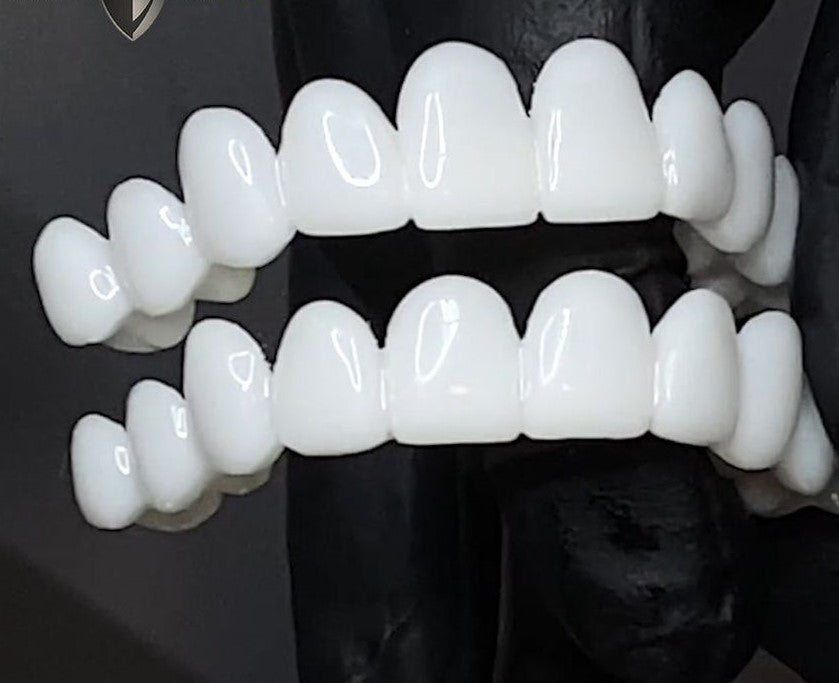 Adjustable Invisible Whitening Braces – 100% Holeless Design for a Natural, Perfect Smile